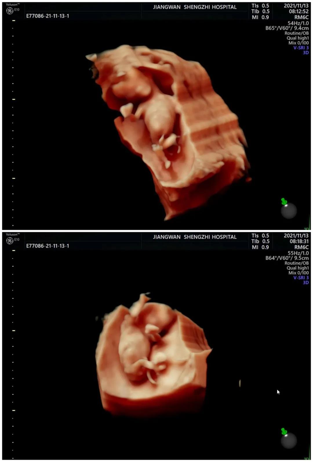 1637285098922215.jpg 1637285098922215.jpg